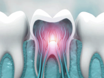 Certificate Course in Dental Endodontics