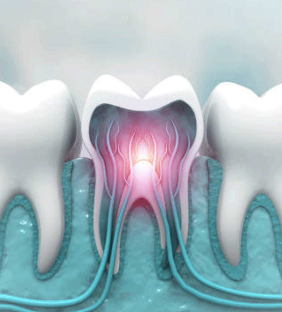 Certificate-Course-in-Dental-Endodontics Certificate-Course-in-Dental-Endodontics