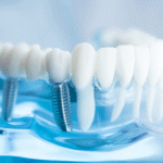 Certificate Course in Dental Prosthodontics