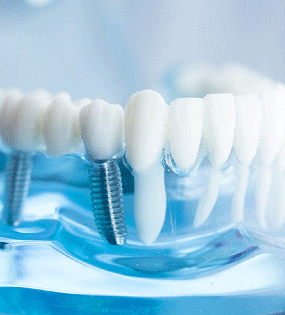 Certificate-Course-in-Dental-Prosthodontics Certificate-Course-in-Dental-Prosthodontics